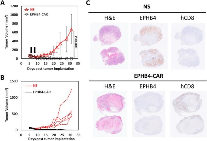 https://cdn.ncbi.nlm.nih.gov/pmc/blobs/dba1/12044661/3f3c81a7d75e/CAS-116-1227-g007.jpg