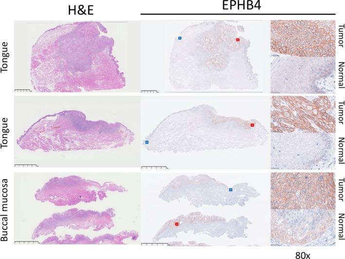 https://cdn.ncbi.nlm.nih.gov/pmc/blobs/dba1/12044661/8cb9890a012c/CAS-116-1227-g002.jpg