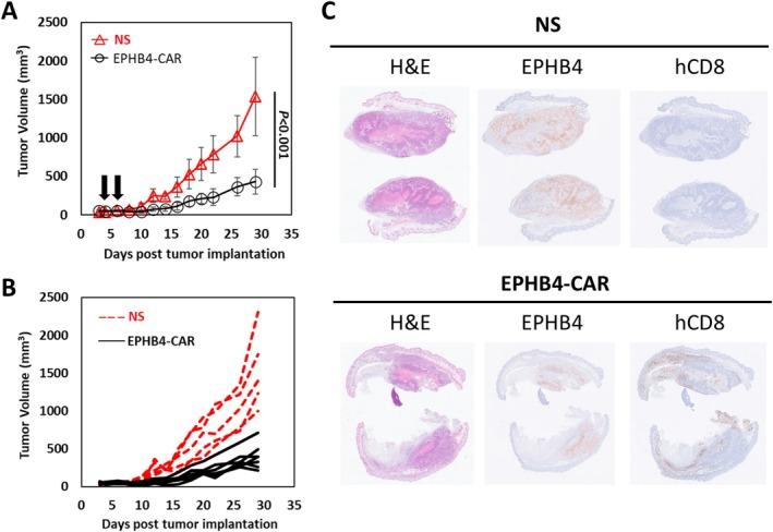 https://cdn.ncbi.nlm.nih.gov/pmc/blobs/dba1/12044661/ab4bd56784c6/CAS-116-1227-g004.jpg