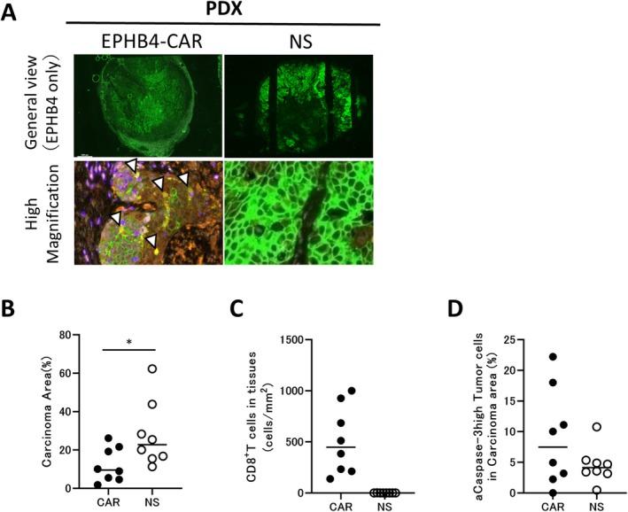 https://cdn.ncbi.nlm.nih.gov/pmc/blobs/dba1/12044661/e5b33226950e/CAS-116-1227-g005.jpg