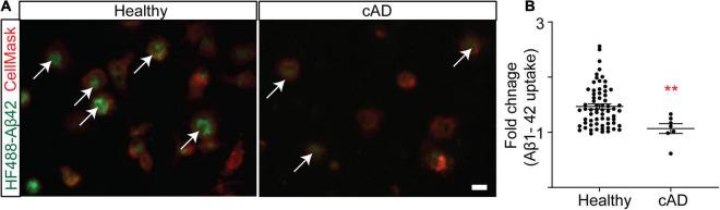 https://cdn.ncbi.nlm.nih.gov/pmc/blobs/dba9/9169965/23b3167cc2c2/fncel-16-894601-g001.jpg