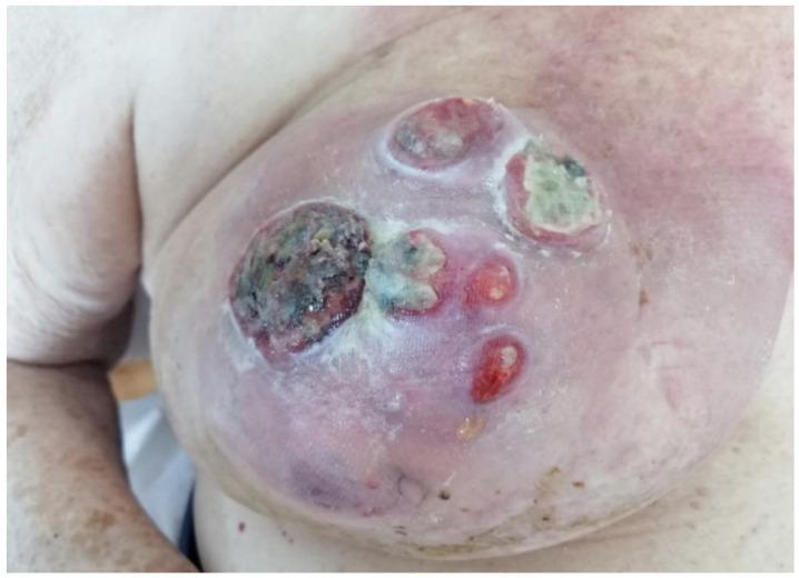 https://cdn.ncbi.nlm.nih.gov/pmc/blobs/dbb1/8745501/2346145a3f99/jcm-11-00126-g006.jpg