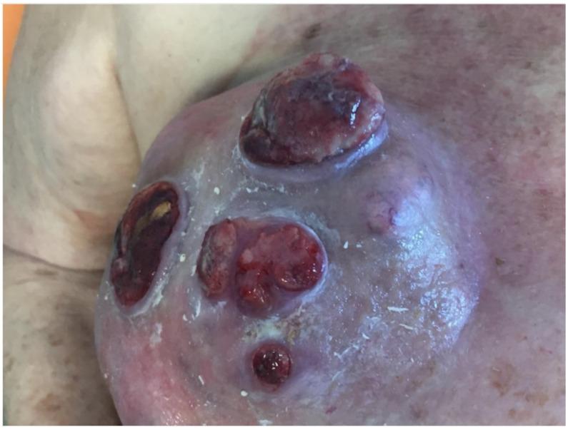 https://cdn.ncbi.nlm.nih.gov/pmc/blobs/dbb1/8745501/311bfbe2dca4/jcm-11-00126-g003.jpg