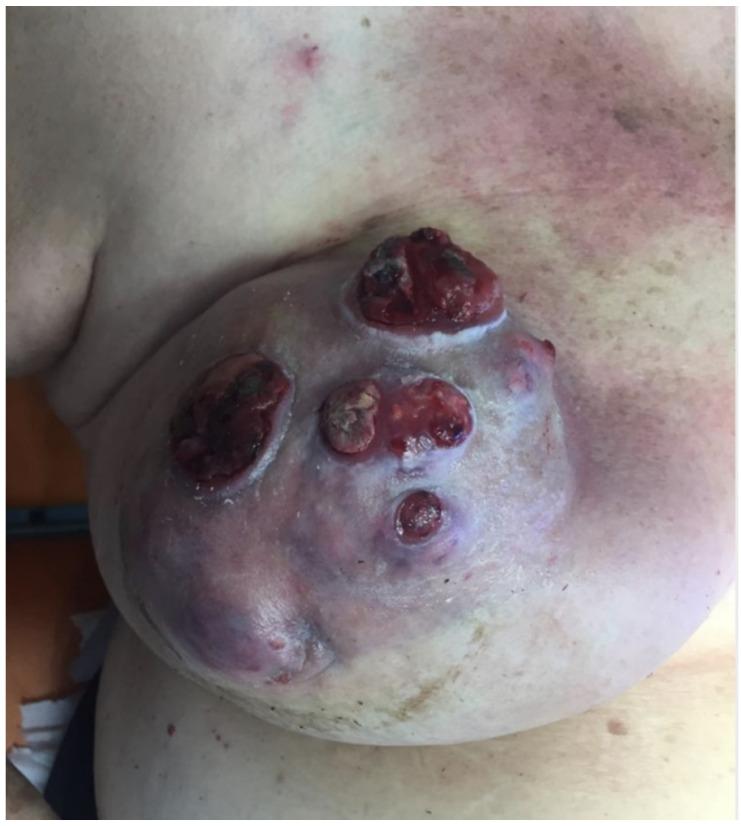 https://cdn.ncbi.nlm.nih.gov/pmc/blobs/dbb1/8745501/544e030b5a54/jcm-11-00126-g005.jpg