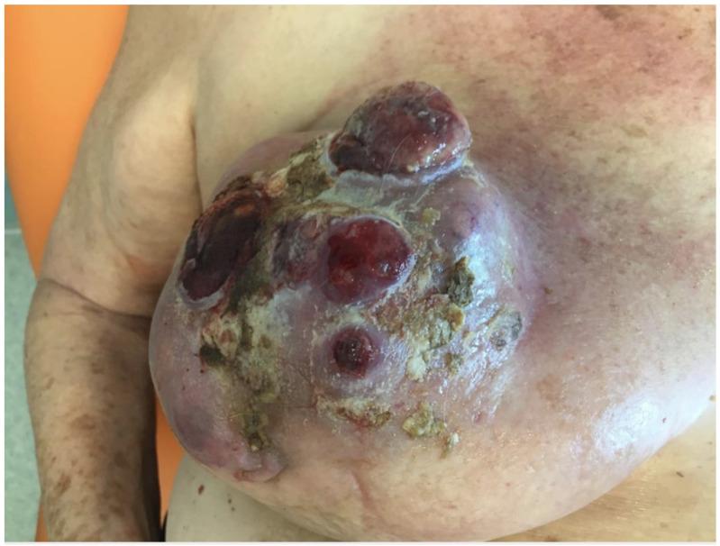 https://cdn.ncbi.nlm.nih.gov/pmc/blobs/dbb1/8745501/5b720ca84be1/jcm-11-00126-g001.jpg