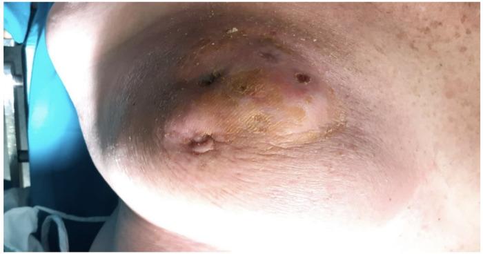 https://cdn.ncbi.nlm.nih.gov/pmc/blobs/dbb1/8745501/8b8d083a63ba/jcm-11-00126-g008.jpg