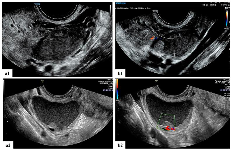 https://cdn.ncbi.nlm.nih.gov/pmc/blobs/dbb3/10606809/64d319920afc/diagnostics-13-03247-g004.jpg