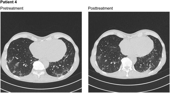 https://cdn.ncbi.nlm.nih.gov/pmc/blobs/dbb8/8572916/2d3f0d6e1e57/40121_2021_493_Fig4_HTML.jpg