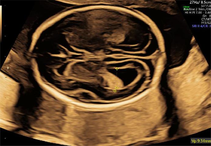 https://cdn.ncbi.nlm.nih.gov/pmc/blobs/dbbe/11402618/97a7880afd54/gr3.jpg