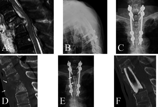 https://cdn.ncbi.nlm.nih.gov/pmc/blobs/dbbf/11163737/575552a1adcb/12891_2024_7565_Fig4_HTML.jpg