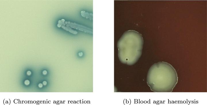https://cdn.ncbi.nlm.nih.gov/pmc/blobs/dbc1/10873726/75589ee77316/gr007.jpg