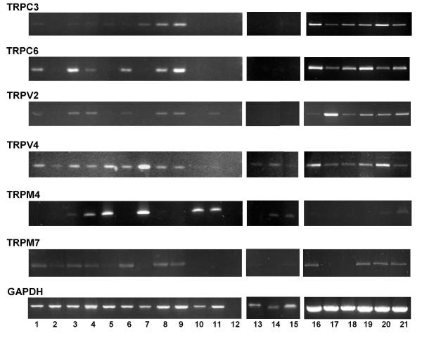 https://cdn.ncbi.nlm.nih.gov/pmc/blobs/dbc1/1557673/0c55cf7e6eb6/1471-2164-7-159-1.jpg