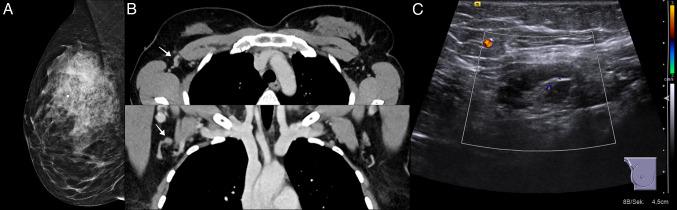 https://cdn.ncbi.nlm.nih.gov/pmc/blobs/dbc2/11798216/5b579707023b/432_2022_4221_Fig1_HTML.jpg