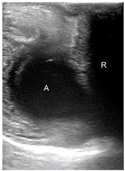 https://cdn.ncbi.nlm.nih.gov/pmc/blobs/dbc8/6861055/adb4be98e0da/cpcem-03-349-g001.jpg