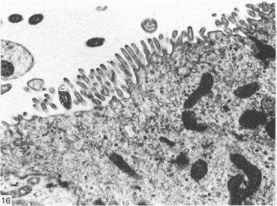 https://cdn.ncbi.nlm.nih.gov/pmc/blobs/dbcb/1165102/15fe2dc3f33d/janat00195-0012-b.jpg