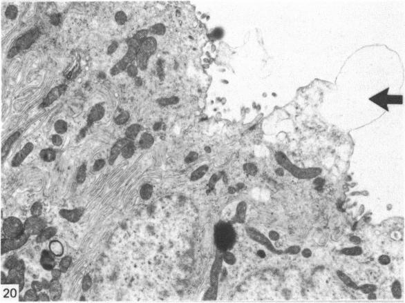 https://cdn.ncbi.nlm.nih.gov/pmc/blobs/dbcb/1165102/7acaf8c290d4/janat00195-0015-a.jpg