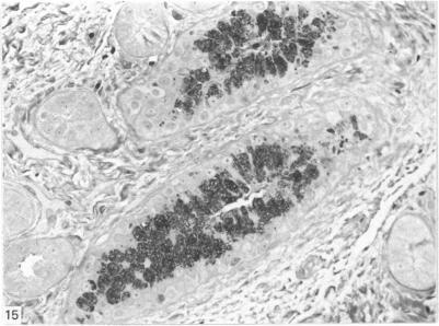 https://cdn.ncbi.nlm.nih.gov/pmc/blobs/dbcb/1165102/bfd7e7ac81f8/janat00195-0012-a.jpg