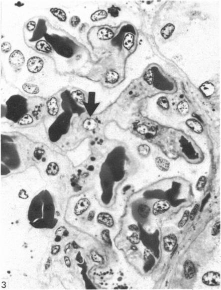 https://cdn.ncbi.nlm.nih.gov/pmc/blobs/dbcb/1165102/d323145fcef8/janat00195-0005-a.jpg