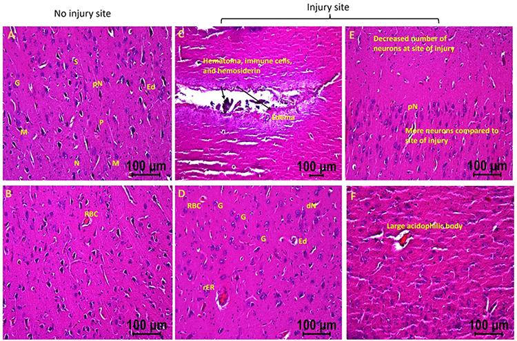 https://cdn.ncbi.nlm.nih.gov/pmc/blobs/dbd0/10883333/7b44bd382547/nihms-1964087-f0002.jpg