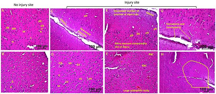 https://cdn.ncbi.nlm.nih.gov/pmc/blobs/dbd0/10883333/a33a5ac77e60/nihms-1964087-f0001.jpg