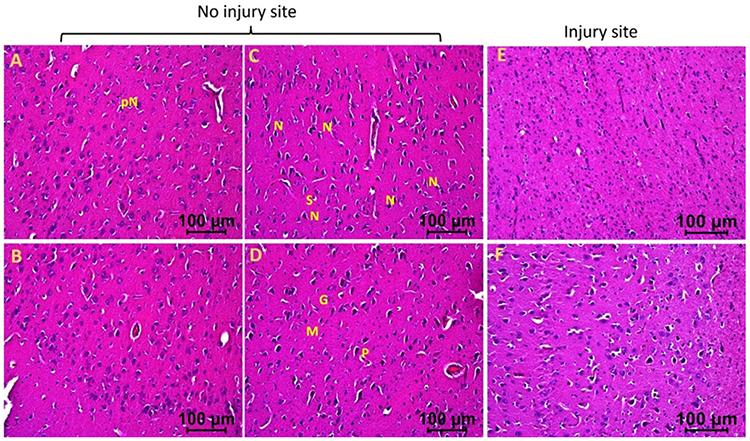 https://cdn.ncbi.nlm.nih.gov/pmc/blobs/dbd0/10883333/fa27e5cacb7e/nihms-1964087-f0004.jpg