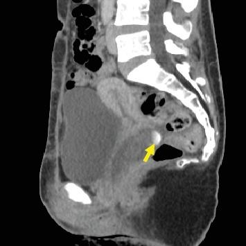 https://cdn.ncbi.nlm.nih.gov/pmc/blobs/dbd2/7128040/93c1dff63d2b/CRIOG2020-6196575.001.jpg