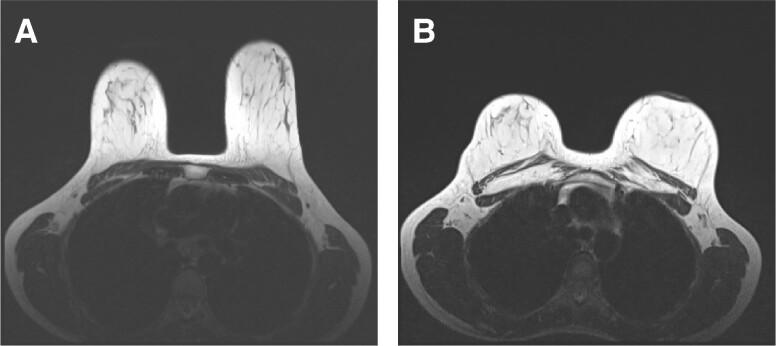https://cdn.ncbi.nlm.nih.gov/pmc/blobs/dbd7/11483719/3c87045001e0/ojae046f3.jpg