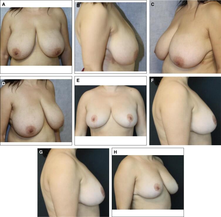 https://cdn.ncbi.nlm.nih.gov/pmc/blobs/dbd7/11483719/63a3f4c75ee5/ojae046f2.jpg