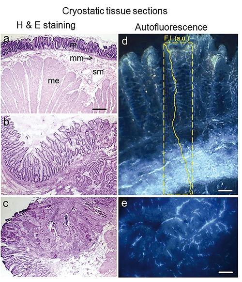 https://cdn.ncbi.nlm.nih.gov/pmc/blobs/dbd9/4289852/8d848753ae50/ejh-2014-4-2461-g003.jpg