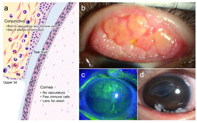 https://cdn.ncbi.nlm.nih.gov/pmc/blobs/dbda/8946931/d4bd35a632cd/cells-11-01051-g001.jpg