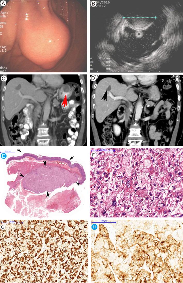 https://cdn.ncbi.nlm.nih.gov/pmc/blobs/dbdc/10851075/49c92161f381/JCTH-12-218-g002.jpg