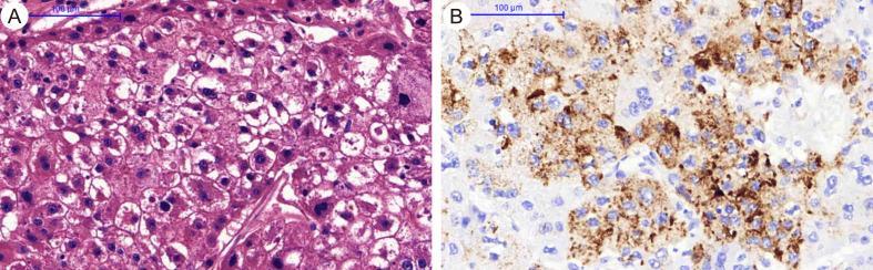 https://cdn.ncbi.nlm.nih.gov/pmc/blobs/dbdc/10851075/8137200cb440/JCTH-12-218-g001.jpg