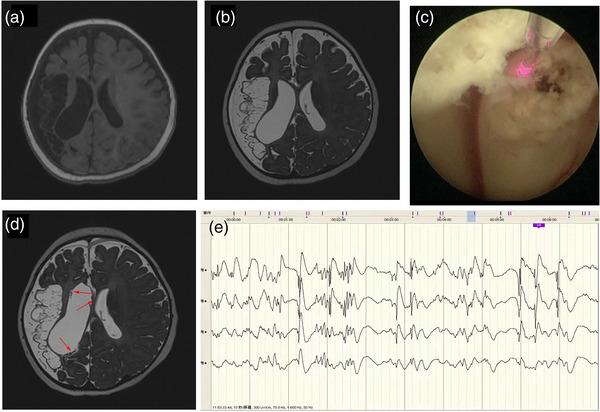 https://cdn.ncbi.nlm.nih.gov/pmc/blobs/dbe2/10570471/3eb93c86812e/BRB3-13-e3184-g003.jpg