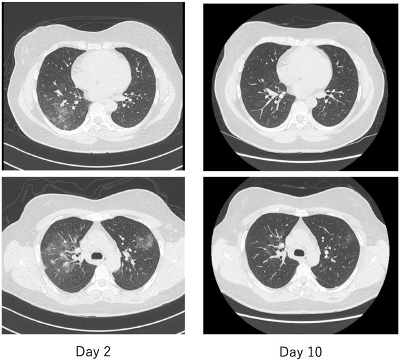 https://cdn.ncbi.nlm.nih.gov/pmc/blobs/dbe3/7766512/0f26a04f152d/ijms-21-09712-g013.jpg