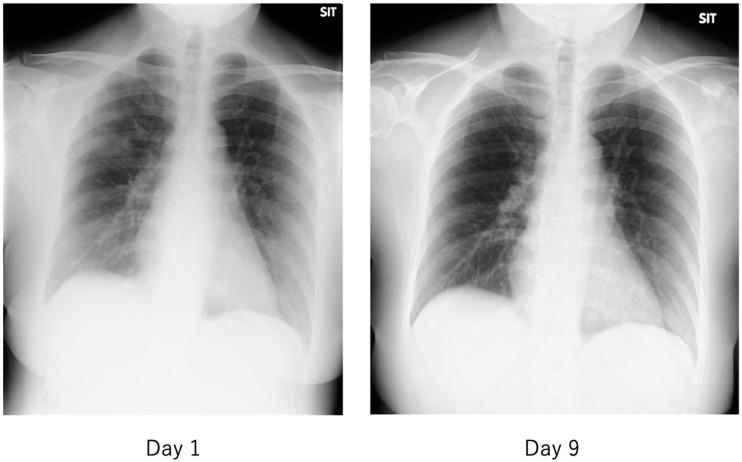 https://cdn.ncbi.nlm.nih.gov/pmc/blobs/dbe3/7766512/d06868840da5/ijms-21-09712-g012.jpg