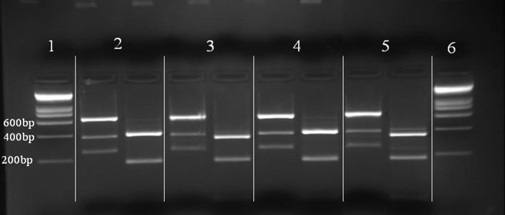 https://cdn.ncbi.nlm.nih.gov/pmc/blobs/dbe5/5432964/dcf58bde5b62/parasite-24-13-fig3.jpg