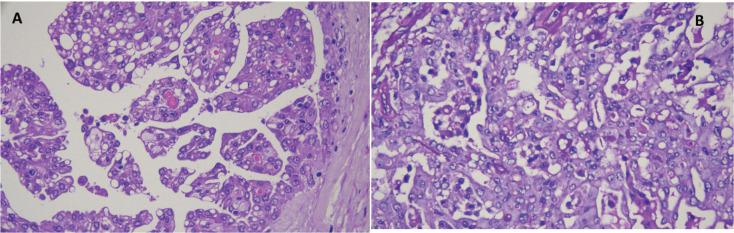 https://cdn.ncbi.nlm.nih.gov/pmc/blobs/dbed/10129378/9706a89c318c/can-17-1511fig6.jpg
