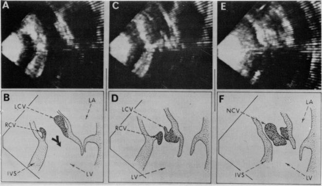 https://cdn.ncbi.nlm.nih.gov/pmc/blobs/dbed/1352516/360eed6889a2/annsurg00146-0017-a.jpg