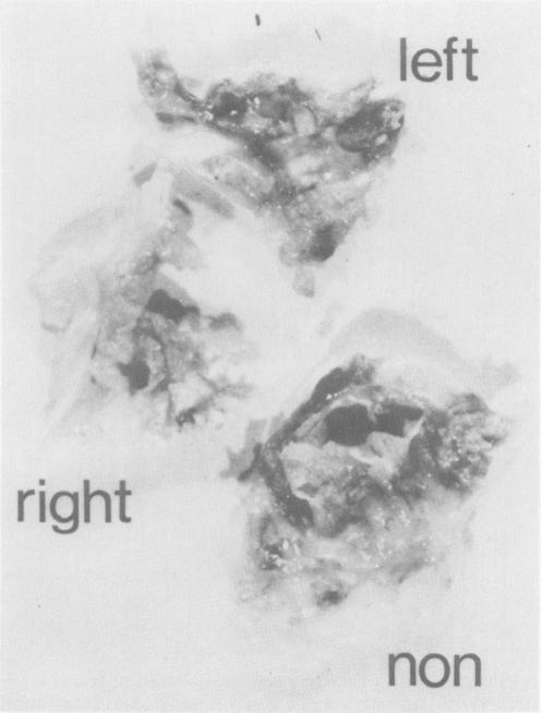 https://cdn.ncbi.nlm.nih.gov/pmc/blobs/dbed/1352516/8aeb521ceec1/annsurg00146-0018-a.jpg