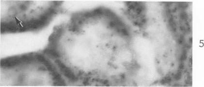 https://cdn.ncbi.nlm.nih.gov/pmc/blobs/dbed/1949803/e7f8d7f92705/amjpathol00310-0212-e.jpg