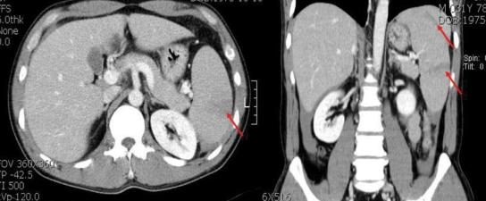 https://cdn.ncbi.nlm.nih.gov/pmc/blobs/dbed/2799964/0328478b2a3a/ymj-51-138-g001.jpg