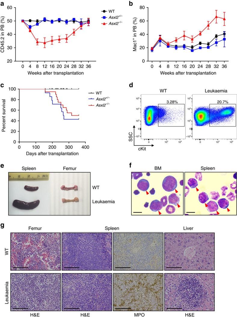 https://cdn.ncbi.nlm.nih.gov/pmc/blobs/dbf1/5472177/8384333a5fe3/ncomms15456-f4.jpg