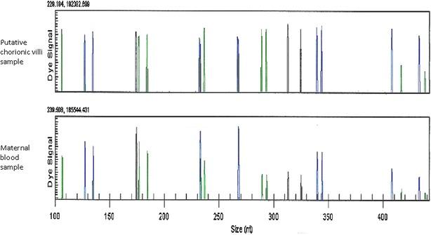 https://cdn.ncbi.nlm.nih.gov/pmc/blobs/dbf5/4920787/b73959028ece/40064_2016_2594_Fig2_HTML.jpg
