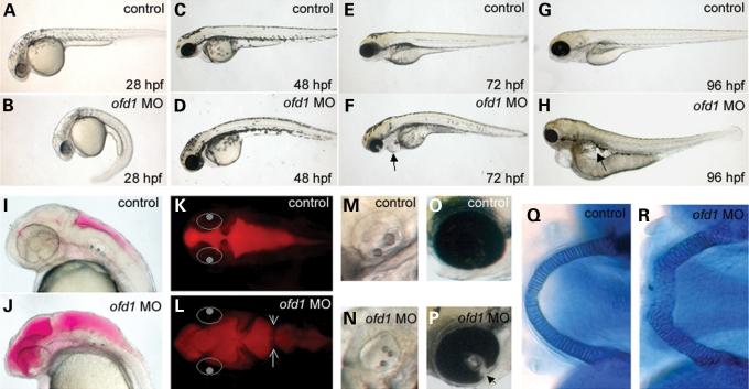 https://cdn.ncbi.nlm.nih.gov/pmc/blobs/dbf9/2638777/6142aa7d4312/ddn35602.jpg