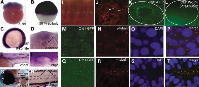 https://cdn.ncbi.nlm.nih.gov/pmc/blobs/dbf9/2638777/75690f8a5b15/ddn35601.jpg