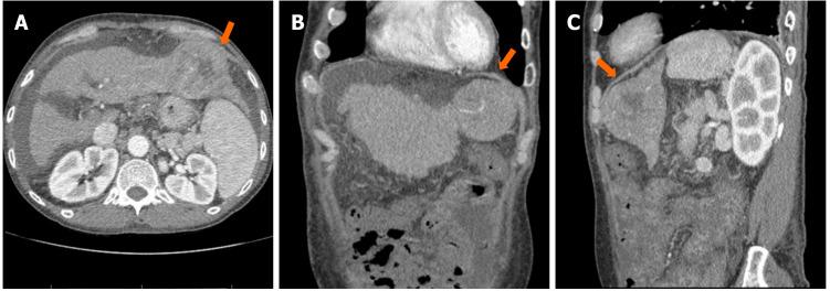 https://cdn.ncbi.nlm.nih.gov/pmc/blobs/dbf9/7475778/350e968fc4a6/WJH-12-519-g001.jpg