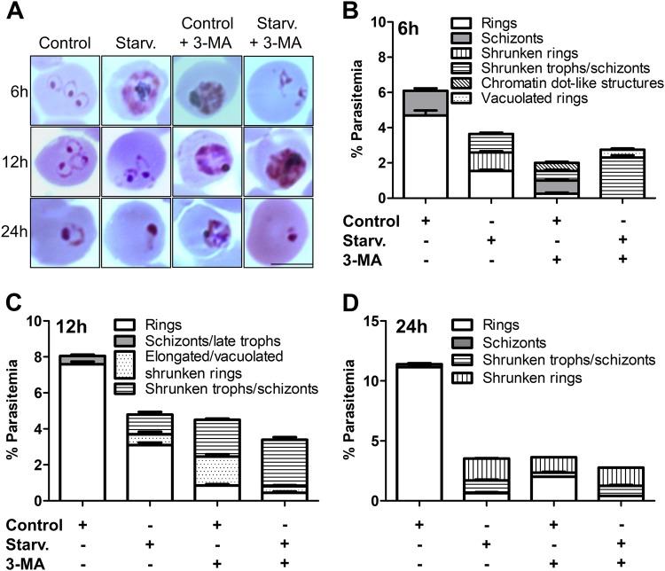 https://cdn.ncbi.nlm.nih.gov/pmc/blobs/dbfe/6170468/f7bd2e04dcd8/41420_2018_107_Fig4_HTML.jpg