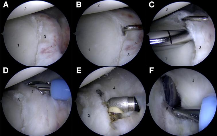 https://cdn.ncbi.nlm.nih.gov/pmc/blobs/dc07/8252819/a2fec15ed649/gr4.jpg