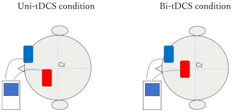 https://cdn.ncbi.nlm.nih.gov/pmc/blobs/dc09/9029581/6ead8c580fb9/brainsci-12-00452-g004.jpg