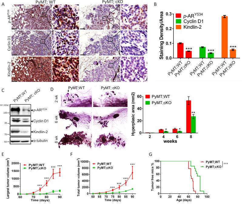 https://cdn.ncbi.nlm.nih.gov/pmc/blobs/dc0b/9122951/5a01cdaf943f/41419_2022_4945_Fig5_HTML.jpg